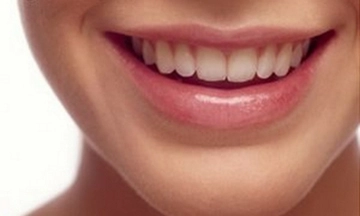 Ön Diş Dolgusu Nedir ve Nasıl Yapılır?